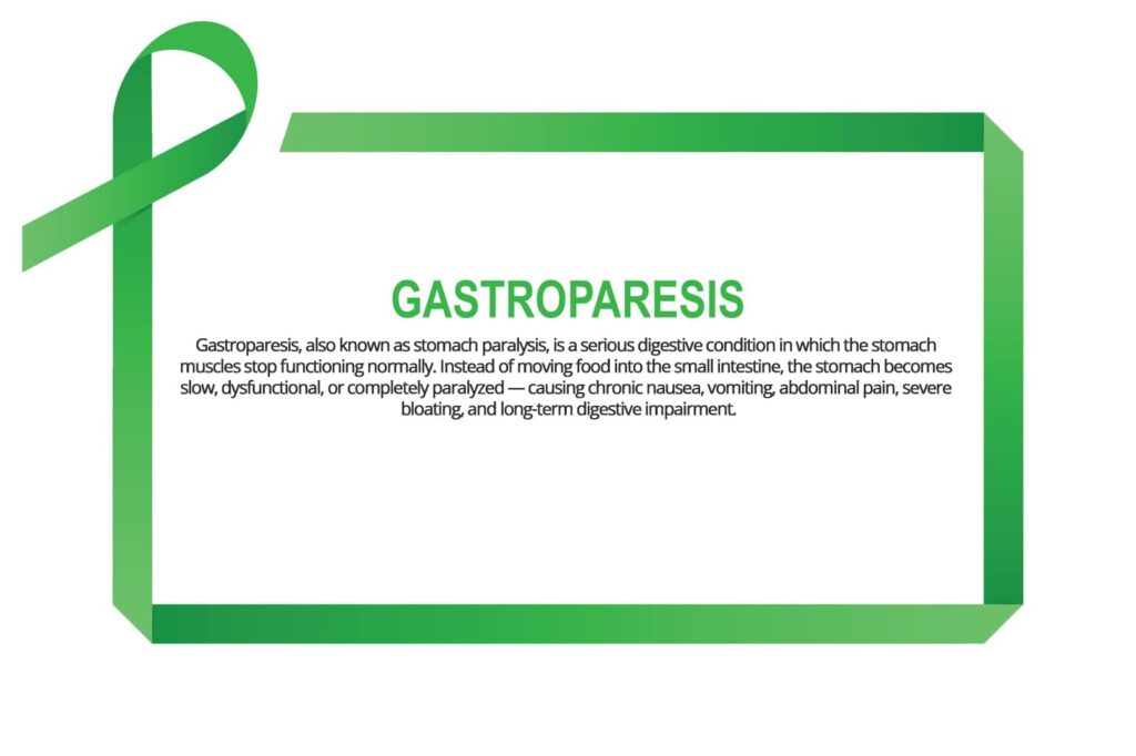 Gastroparesis (Stomach Paralysis) Gastroparesis