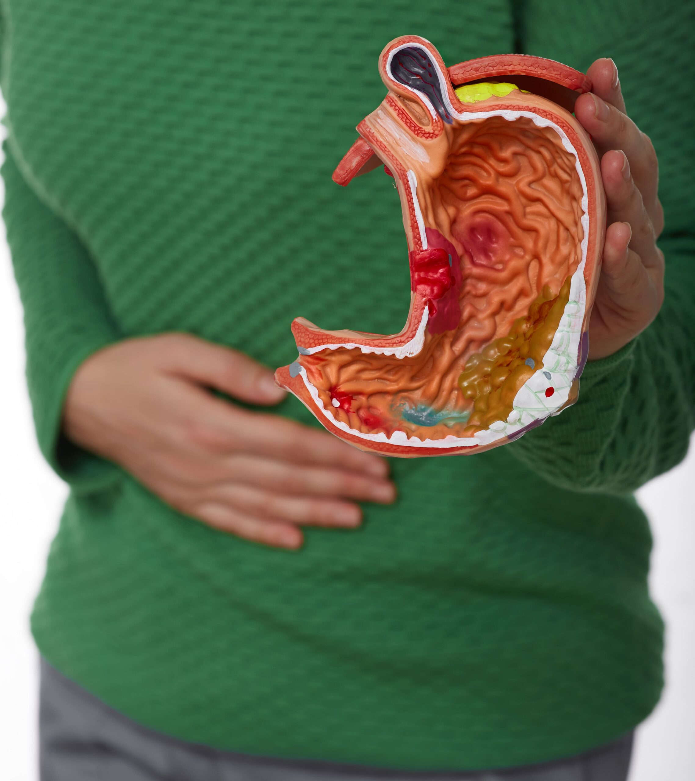 Gastroparesis Injury Lawsuits