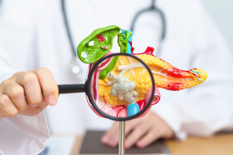 Pancreatitis Lawsuits